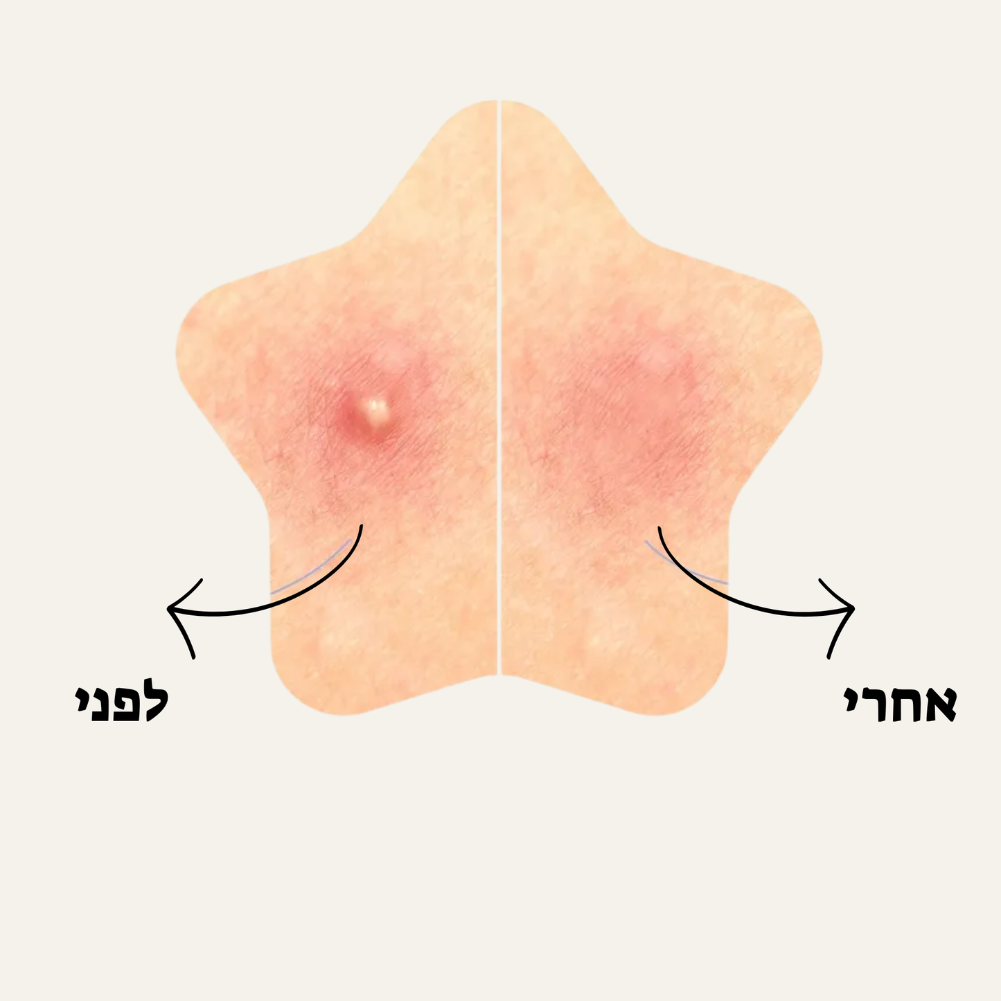 מדבקות כוכב לפצעונים 200 יחידות