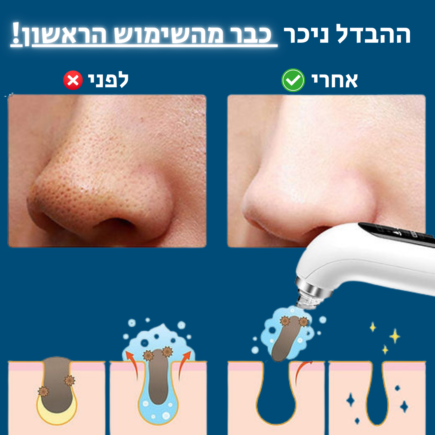 "תוצאות מיידיות – הפנים לפני ואחרי ניקוי עם שואב שחורים"

