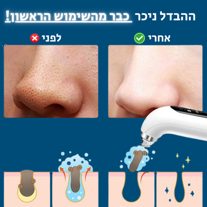 "תוצאות מיידיות – הפנים לפני ואחרי ניקוי עם שואב שחורים"


